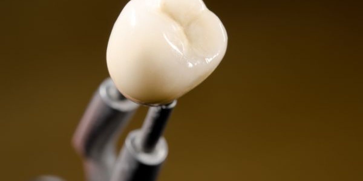 dental-crown-2003
