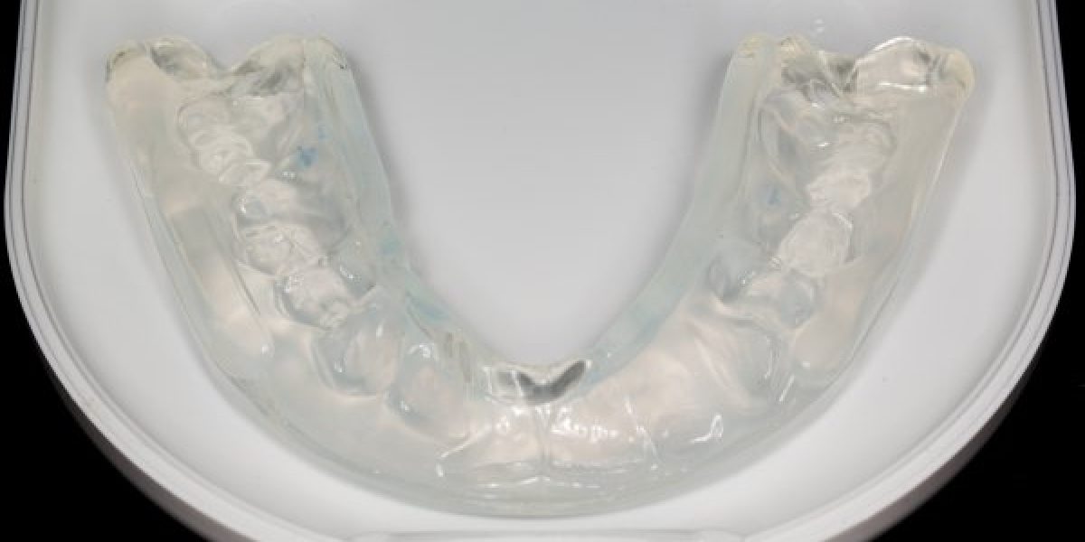 invisalign-dentist20161
